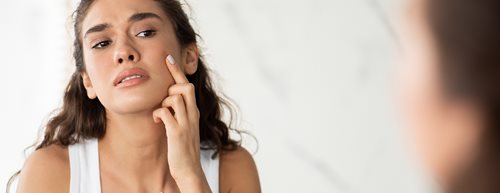 Hormonálne akné: Dermatologička vysvetľuje, čo sa s tým dá robiť